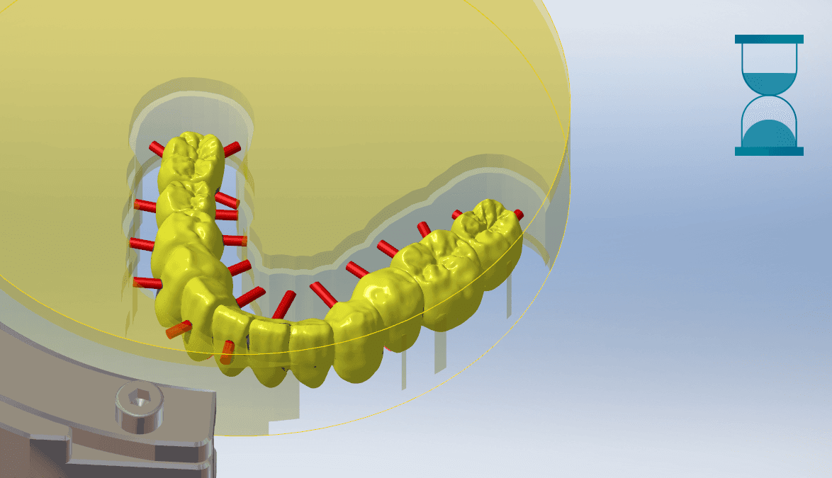 3D model of dental structure with red rods around yellow teeth in a transparent circular frame.