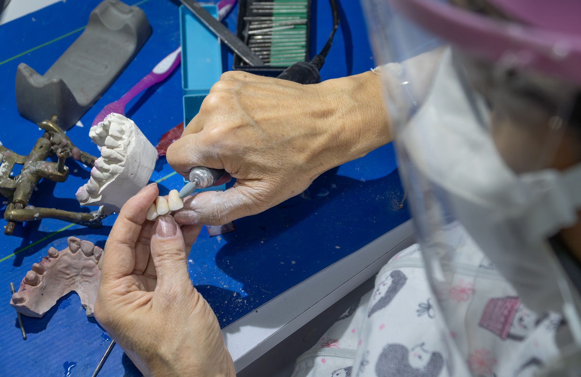 Dental technician make denture prothesis with motor tool in dental laboratory. Hands of dental technician make denture prothesis